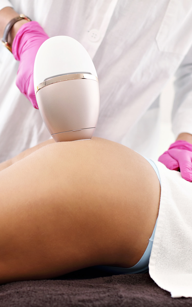 woman getting cosmetic procedure at salon for stretch marks on butt