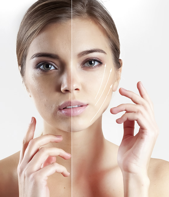 woman with sagging skin on face