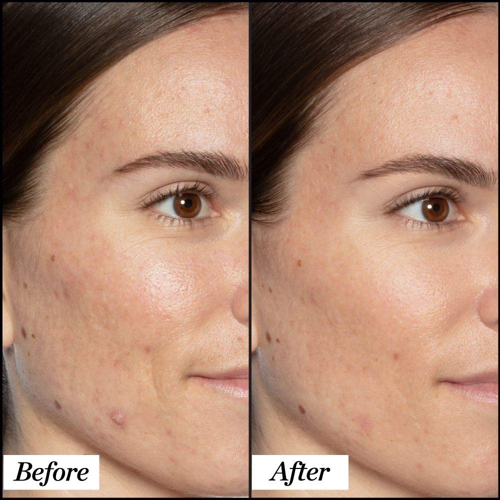 mature ski nresults before after Sunday Riley serum