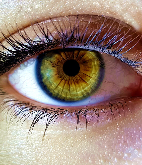 strained eyes