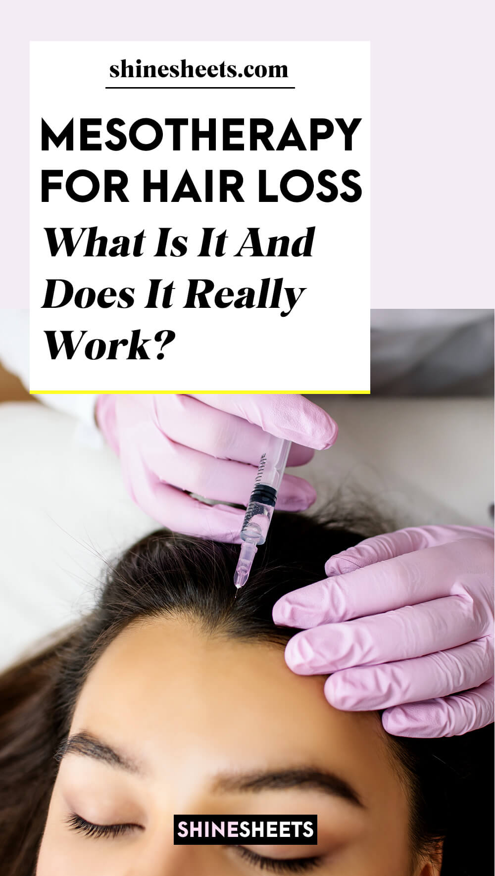 woman in procedure of mesotherapy for hair loss