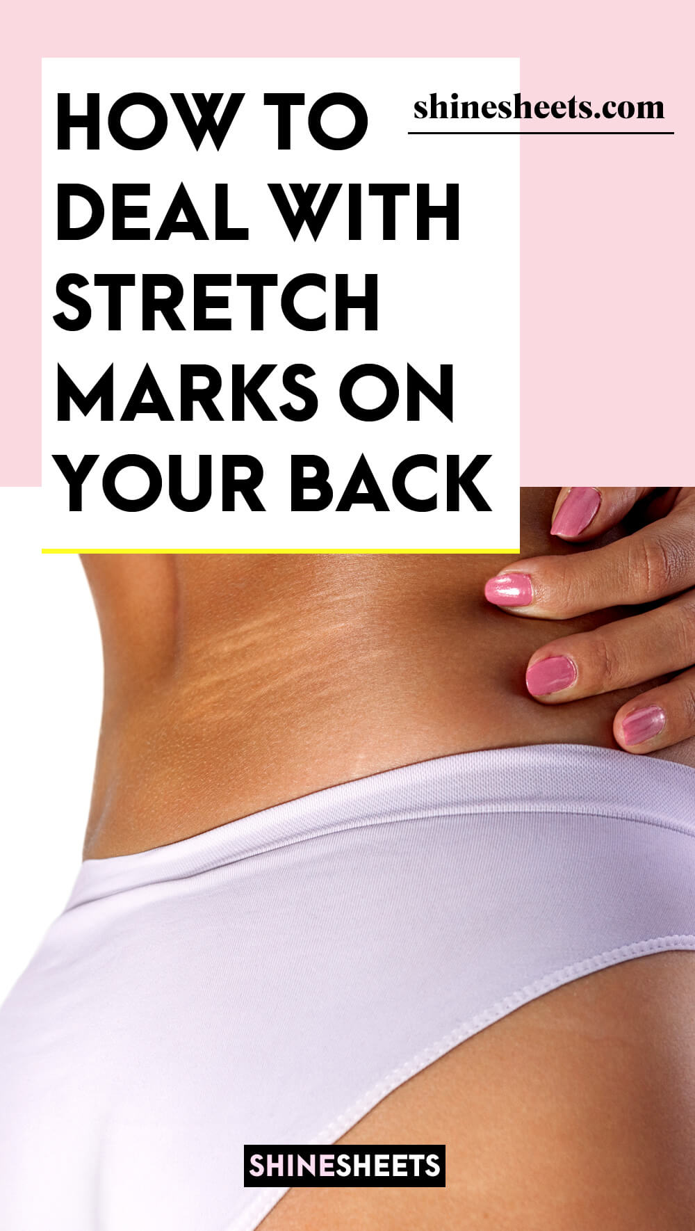 young woman showing her stretch marks on back
