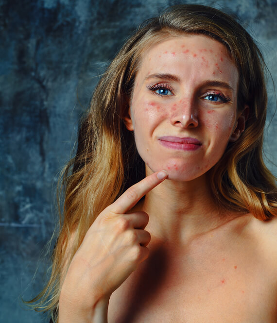 girl with unhealthy skin