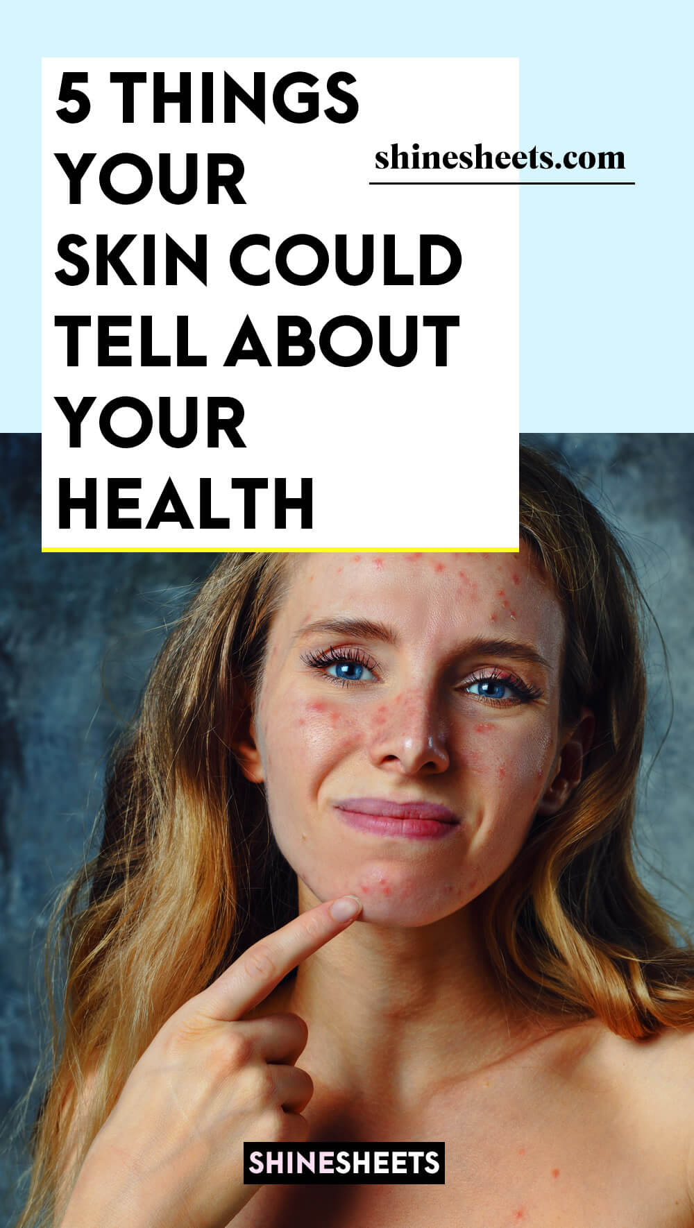 woman with unhealthy skin