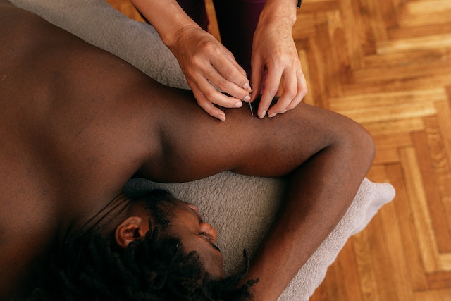 woman performing acupuncture on a man's arm