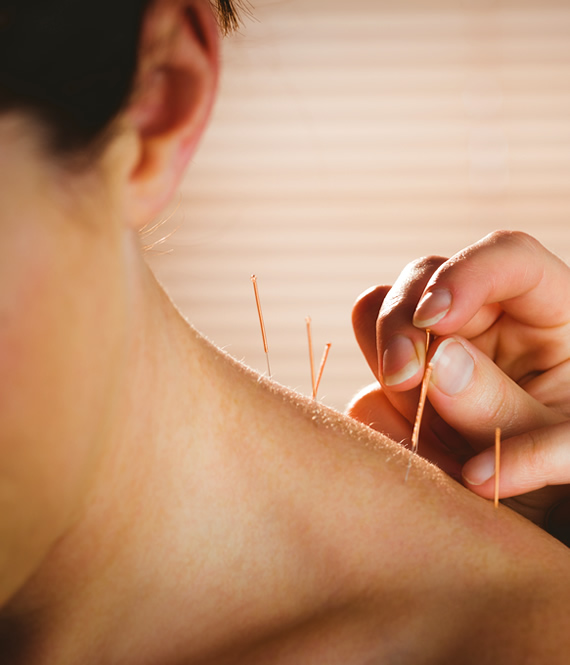 receiving anti-aging acupuncture therapy treatment