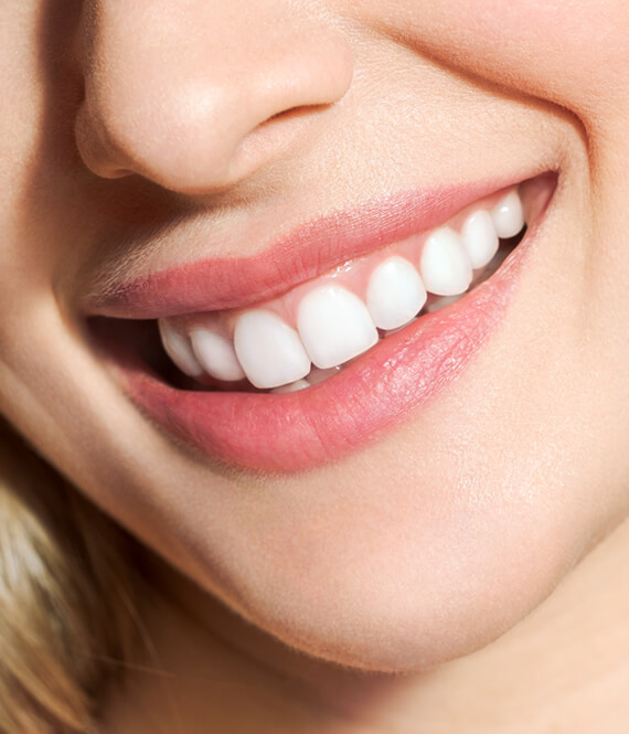 perfect healthy smile after getting a dental implant