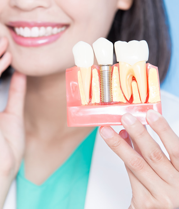 smiling dentist holding a tooth implant visual
