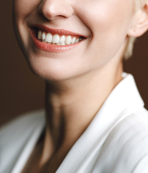 smiling woman with porcelain veneers
