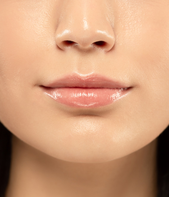 plump lips with lip fillers