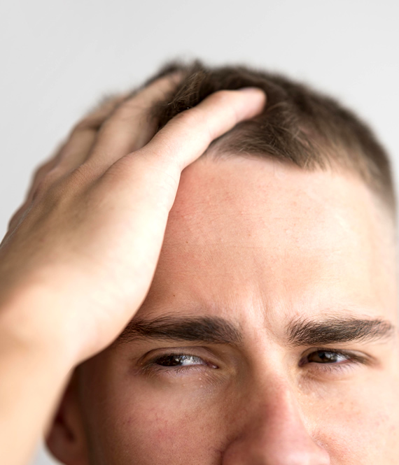 person assessing hair loss intensity on his head