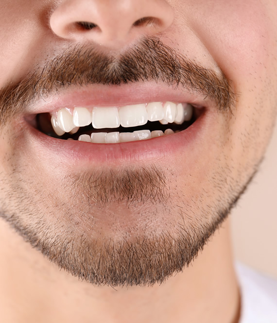 young person with perfectly white teeth