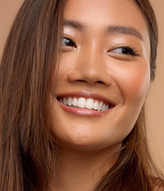 gorgeous smile after dental veneers installation