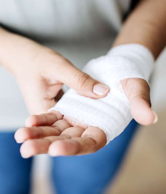 woman holds her properly treated hand with small cut