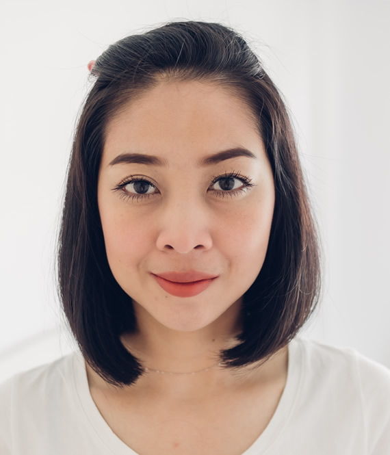 woman with a chin implant
