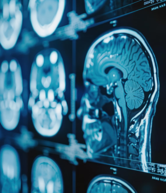 medical imaging