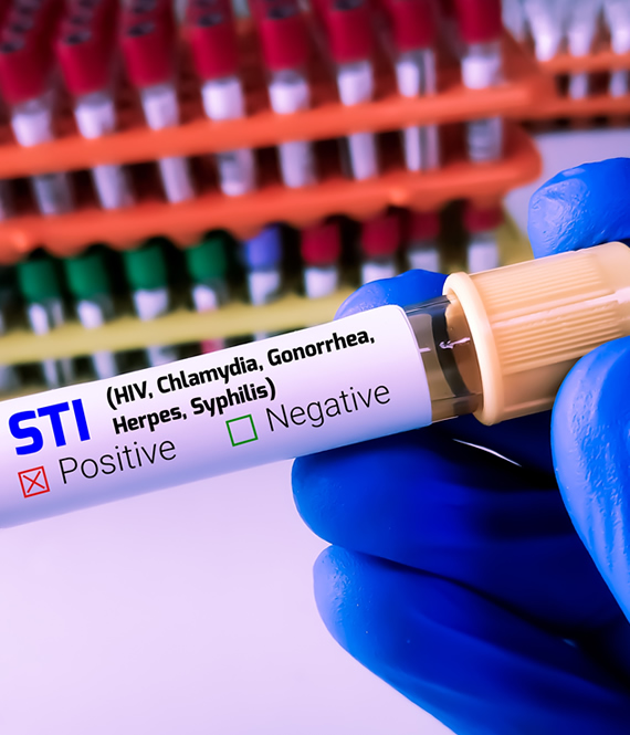 positive sti test
