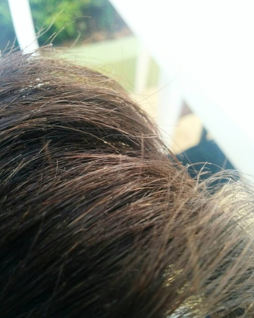 What are split ends - close up view of split hair